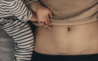 Cesarean Awareness Month: A Different Kind of Birth Story